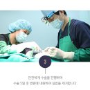 강남미의원 | 앞트임복원 수술 유명한 강남미의원 상담 후기