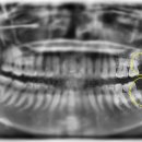 서울산성플란트치과의원 이미지