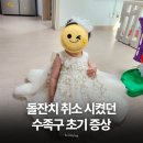 수족구 초기증상부터 예방까지, 돌잔치까지 취소하게 만든 우리 딸의 수족구 경험담