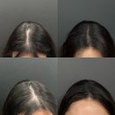 동두천시립도서관 | 동두천 두피smp 고양 , 양주 자연스럽게 잘하는곳 (feat.내돈내산 )