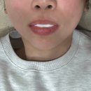루메이 | 금정구 피부관리 잘하는 곳 루메이 에스테틱 앰플 기기 맞춤관리 솔직 후기