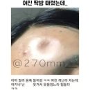 이마필러 팅팅탱탱 후라이팬 후기♥