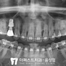 더퍼스트치과의원 음성점 이미지