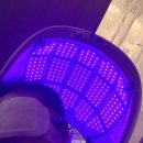 웰킨 두피 탈모 센터 | 평택 두피관리 잘하는곳 웰킨두피탈모센터 후기