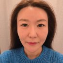 탄탄한의원 | 서면얼굴비대칭교정 한의원 1회로 효과 보고 계속 방문중인 4차까지 후기