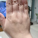 나우썬 | 투엔티크림 0.025% 후기 시작! 닥터나우 처방부터 가격까지 (2주 경과 예정)