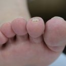 아이캔네일 이미지