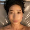 야당피부관리 익스테틱 겨울철엔 링거앰플케어 필수