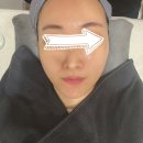 6세대필링 예스필 저자극 케어 리얼후기