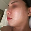 남부터미널피부관리 : 더포레스트 달팡전문 맞춤케어 후기