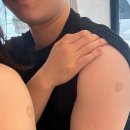 아리채요양병원 | W7. 가다실9가 예방접종 후기｜남자 가다실9가접종｜대구 아리채요양병원｜구미,대구 가다실9가 최저가...