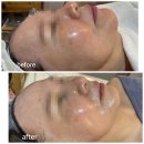 자이언트메디칼 | 강서구피부샵 단 7일 만에 어려 보이는 동안 피부 만드는 법