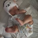아이사랑두헬멧대전센터 | 아이사랑두 두상교정 헬멧 2주 착용 후기! 아이사랑두 추천인 (전국 지점 가능)