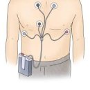 홀터검사 24시간 심전도 검사 :: 목적 비용 이상 알아보자 이미지