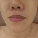 경기광주피부관리 더맑은스킨 경기광주태전점 아몬드필관리 후기
