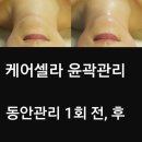 케어셀라 네이버블로그