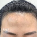 쎄뚜헤어라인