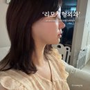 행복한외과병원 | 신논현역병원 ㄹㅁ성형외과, 투턱 이중턱지흡입+근육묶기 한달차 후기