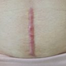 조동약국 | 콘투락투벡스겔 가격 성분 효과 본 사용방법 후기