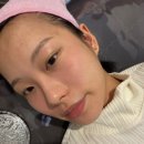 매일한의원 | 가양 한의원 거우침 효과 한 달 후기 딱지 흉터 재발 전후 사진