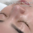 중랑] 상봉여드름관리 블랙헤드 케어 잘하는 곳 ‘블리로움 뷰티크 사가정 본점’ 아름 원장님 리얼 후기