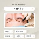 아장속눈썹