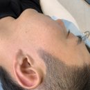 일산두피&눈썹단미토탈뷰티