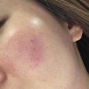 리뉴피부과의원 이미지