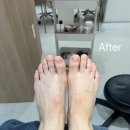 러블리네일 | [서울/서초] 러블리네일아트 발관리 후기🦶🏻피로 싹 풀리는 힐링타임✨