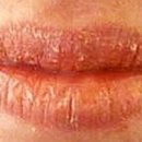 ◆ 트는 입술 보호방법.림밥.챕스틱 이미지