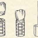 치과 치료의 역사 이미지