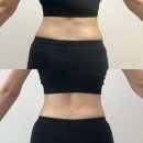 돼지옆꾸리 | 수원 비만클리닉 지방분해주사 시술후기 (병원정보, 식단, 가격, 꿀팁, 붓기)