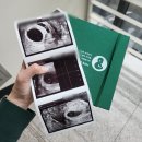 남해군보건소 | 3차 시험관 성공-보건소 임산부 등록, 베팡 국민행복카드 발급, 임신출산 진료비 신청 (+서초구 임신...