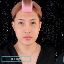 어바웃메디 이미지