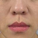 벨로의원 이미지