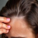 빗질만 바꿔도 두피 건강이 달라지는 이유 이미지