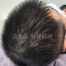 위너뷰티 이미지