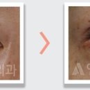 앤써성형외과의원 이미지