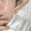 아이이뽀 | 복합성 수부지 피부관리 방법 아이이뽀 테오트리 안산 여드름 압출 후기