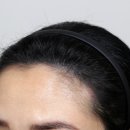 원효초교 | 용산두피문신, 전후 사진으로 보는 탈모커버 효과는?