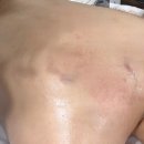 허니에스테틱 | 체형발란스에 다이어트까지 가능한 허니에스테틱 풍동점 등관리 후기