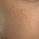 2500 | 다이소 레티놀 세럼/2500 크림 사용 후기 및 효과