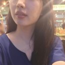 미소핀피부과 | 삼성역피부과 팔자주름없애기 실리프팅 내돈내산 후기
