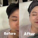 &lt;리숨에스테틱&gt;/진월동피부관리/광주맨즈관리/광주맨즈피부관리/광주예랑피부관리/광주예신피부관리