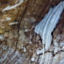 웃는하루치과의원 이미지