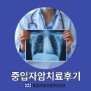 서초대로 360 | 초기 폐암에 대해 높은 완치율을 기대할 수 있는 중입자암치료후기