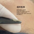 뉴세라