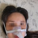 세교수면보청기센터 | 수면무호흡증 진단 위한 수면다원검사 결과와 리얼 양압기 후기 2부