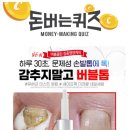 미라클 네일