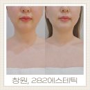 상남동282 | 창원에스테틱 282에스테틱 상남동 풀페이스 웨딩관리로 이중턱살제거 후기